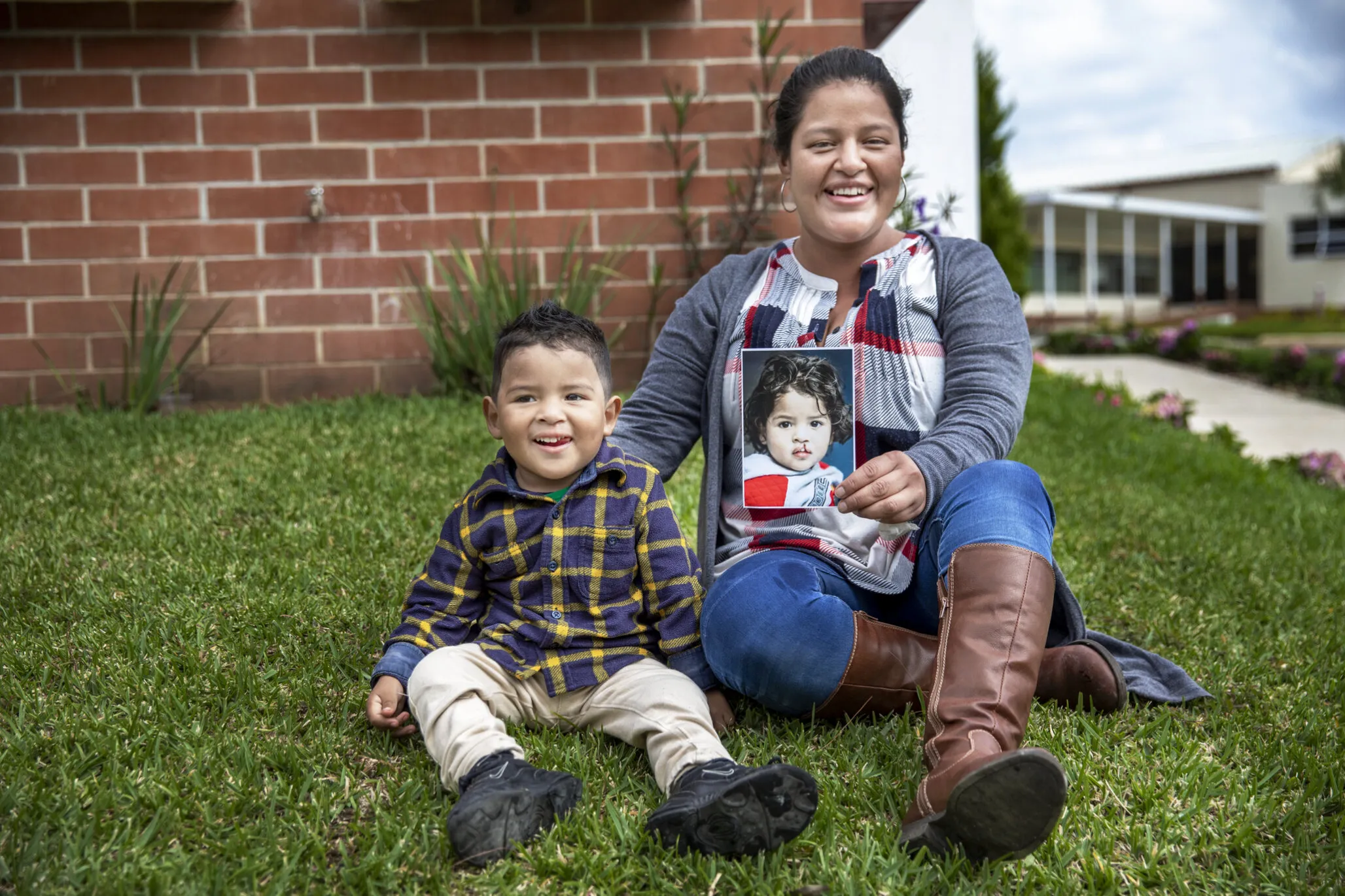 Dilan with his mom, Sandy, one year after cleft lip surgery.