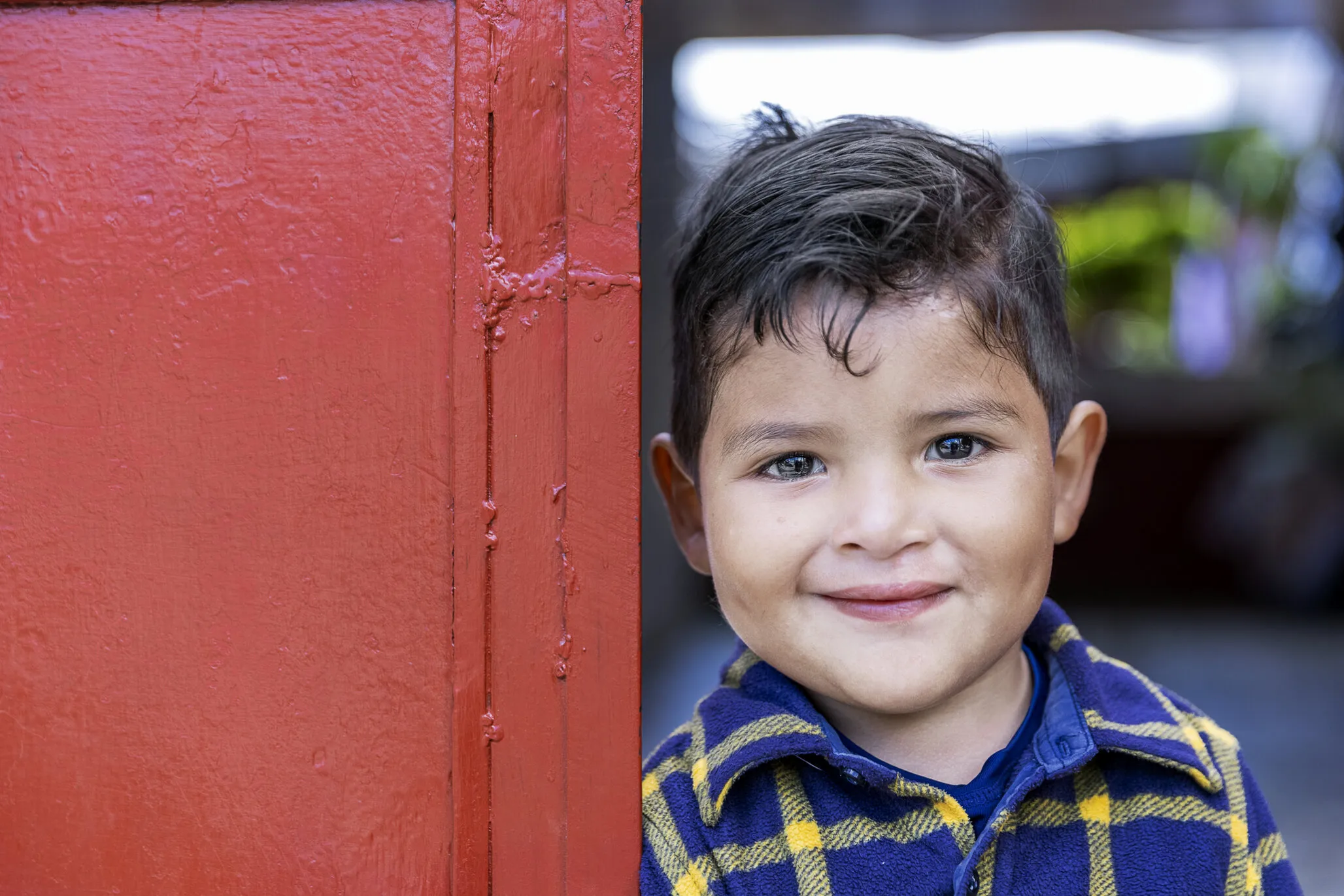 Four-year-old Dilan, after surgery.