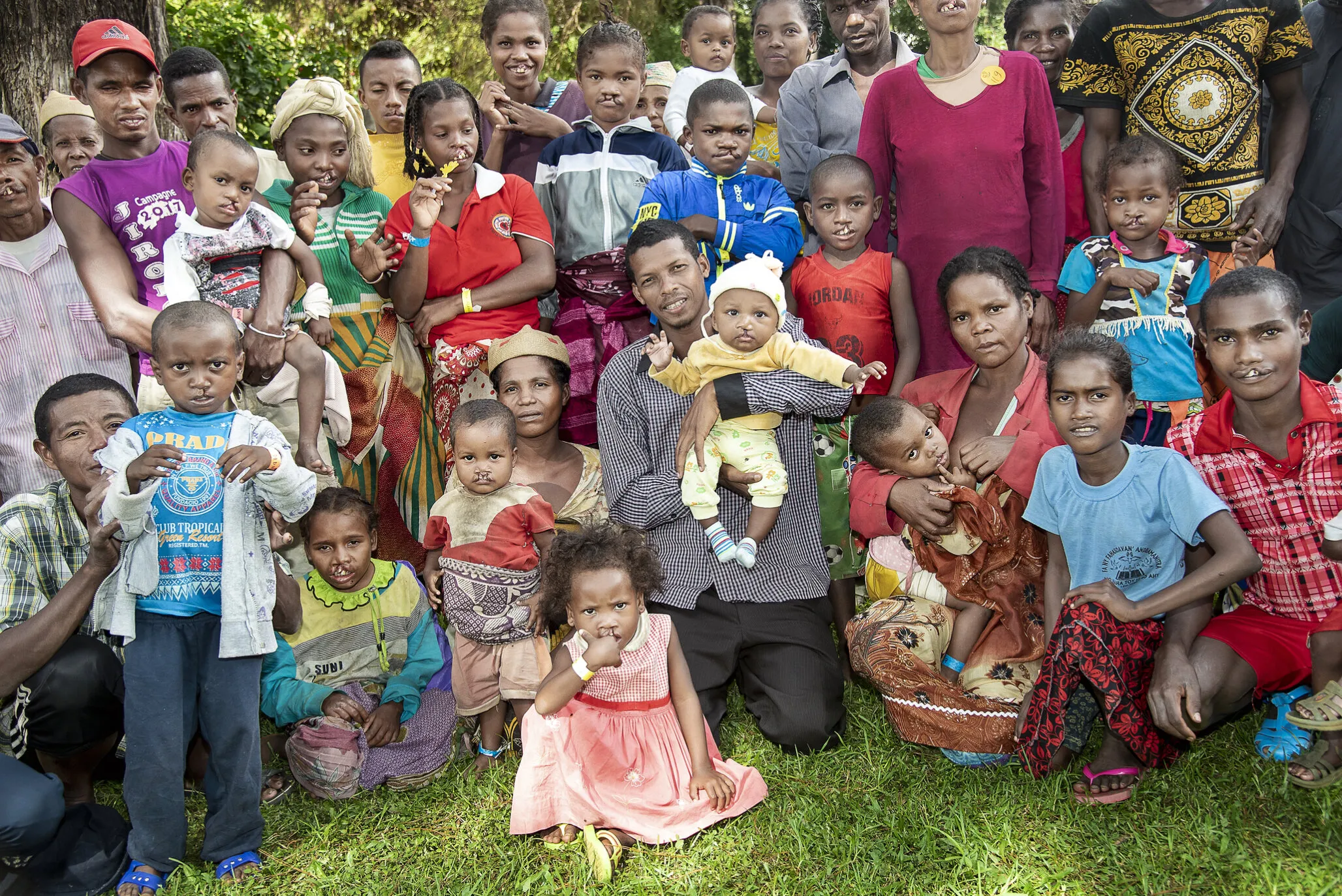 Fidelis, pictured here in the center, poses with some of the 42 patients and their family members who he has helped bring to Operation Smile’s care in Madagascar as a patient advocate.