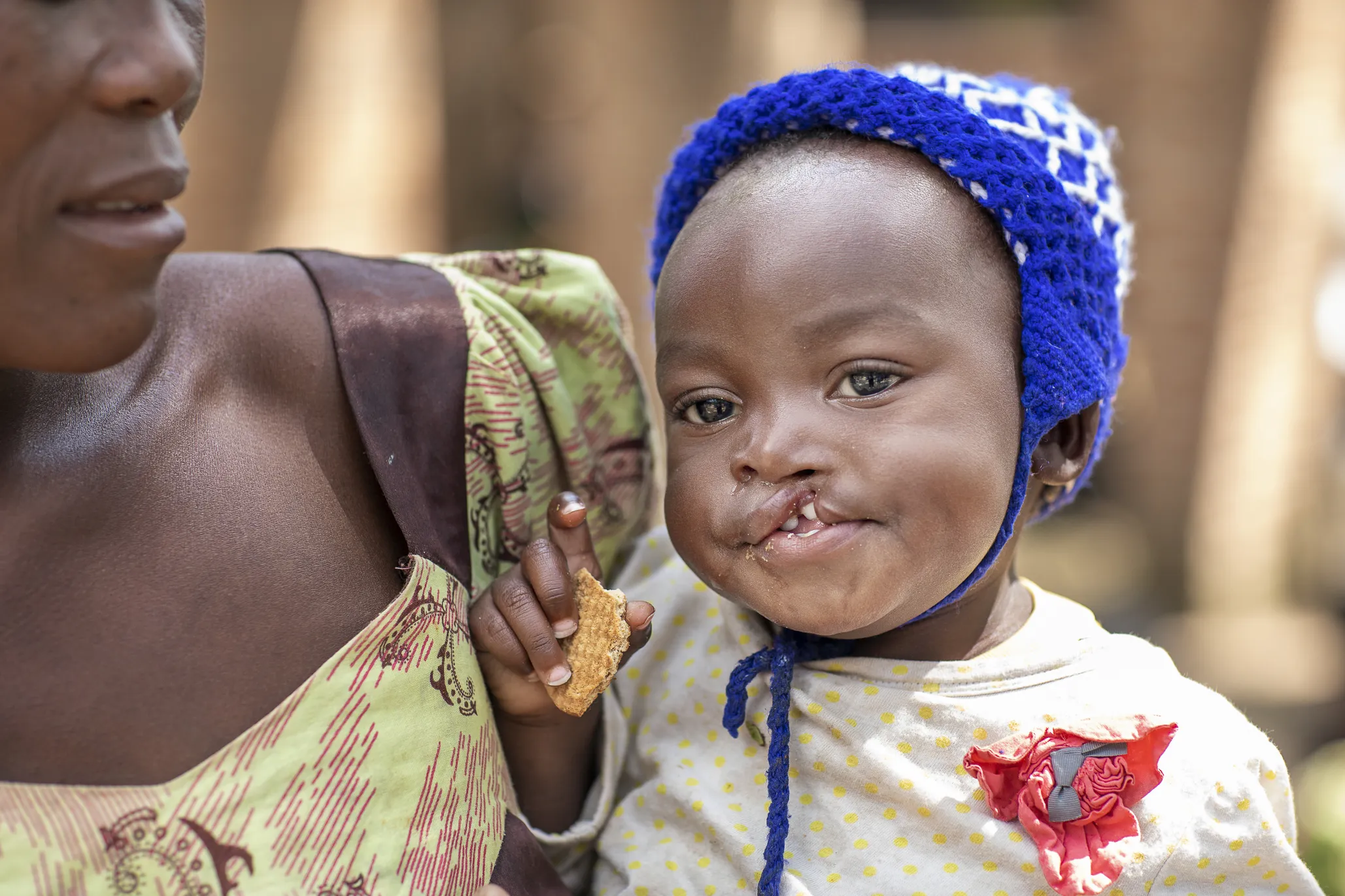 Sunday has a quick snack during a program in Malawi.