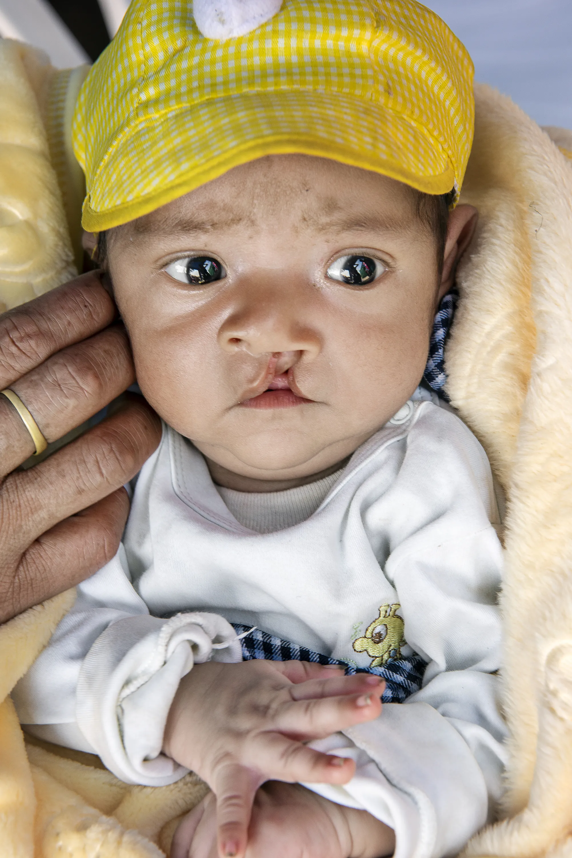 Two-month-old Kyungmin during screening day of Operation Smile Peru's 2019 surgical program.