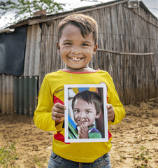 Pedro smiles while holding his photo from before surgery.