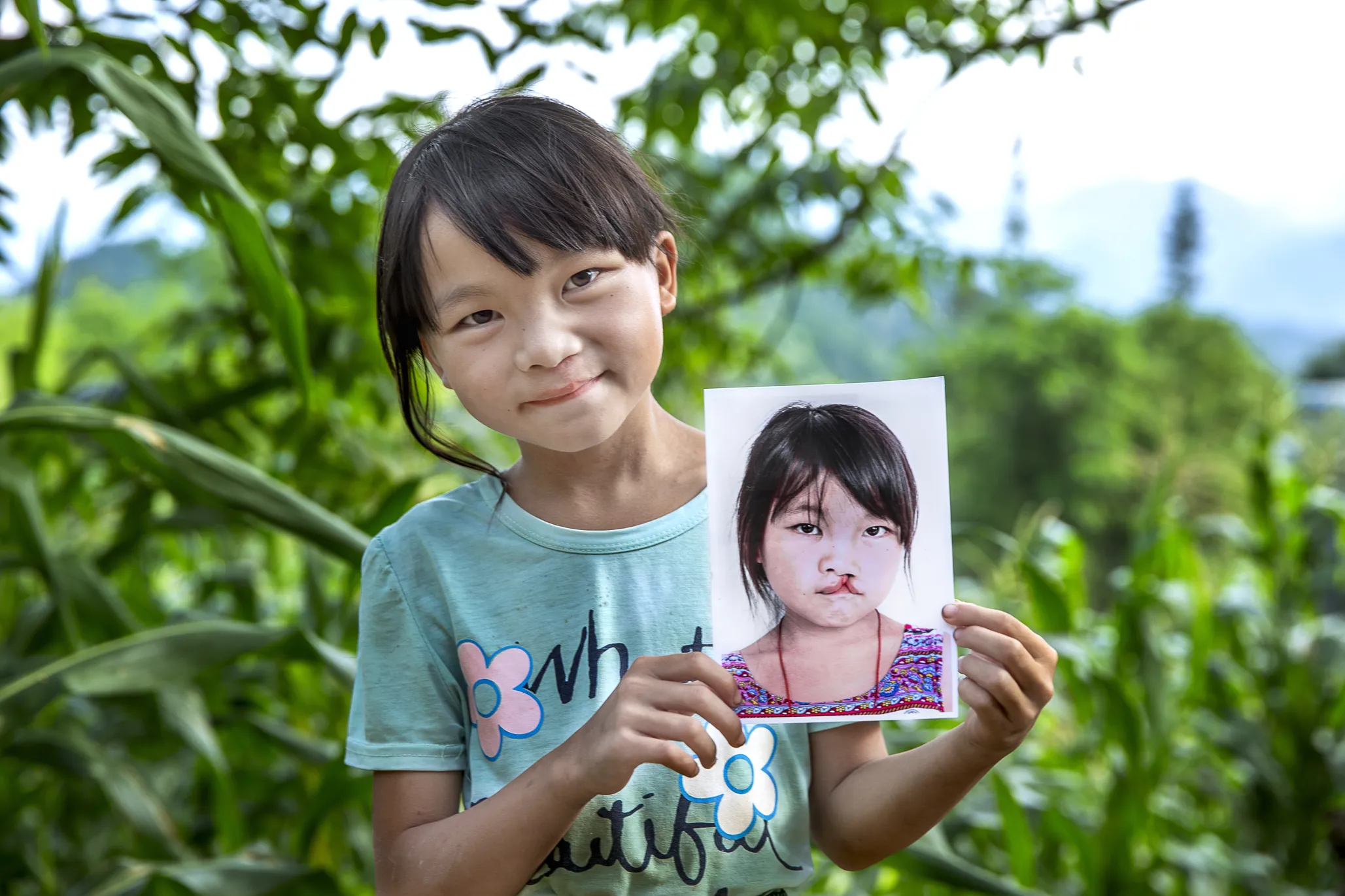 Ying, after surgery, holds her before photo.