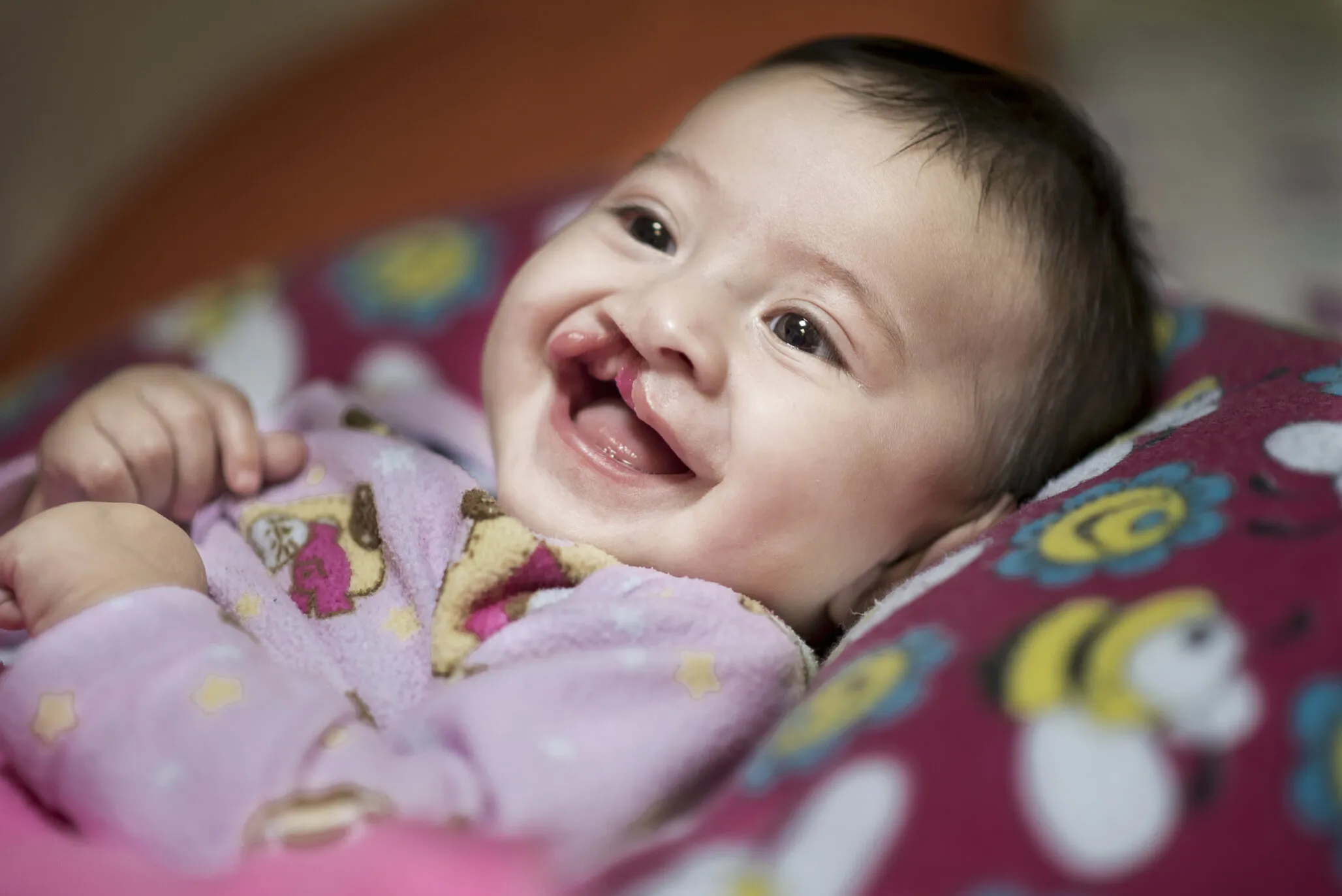 A smiling Luciana, before surgery.