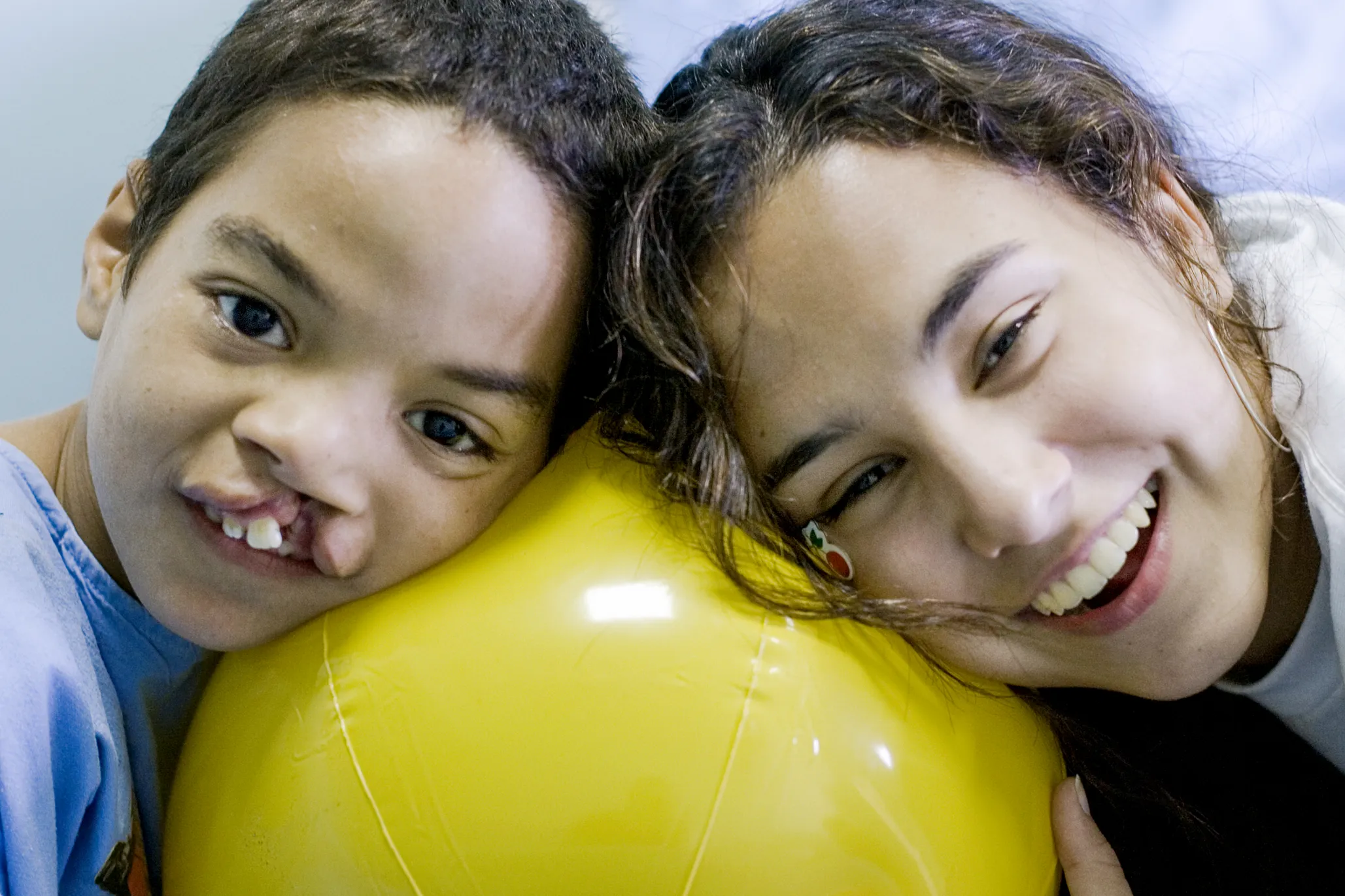 A patient a student volunteer smile before surgery during a surgical program in Egypt in 2007.