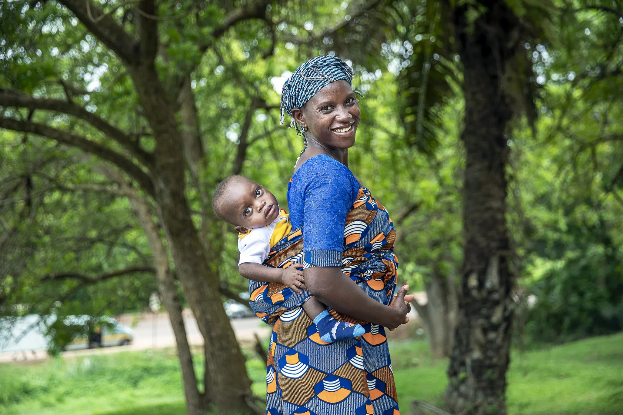 Moses and Aba after his cleft lip surgery.