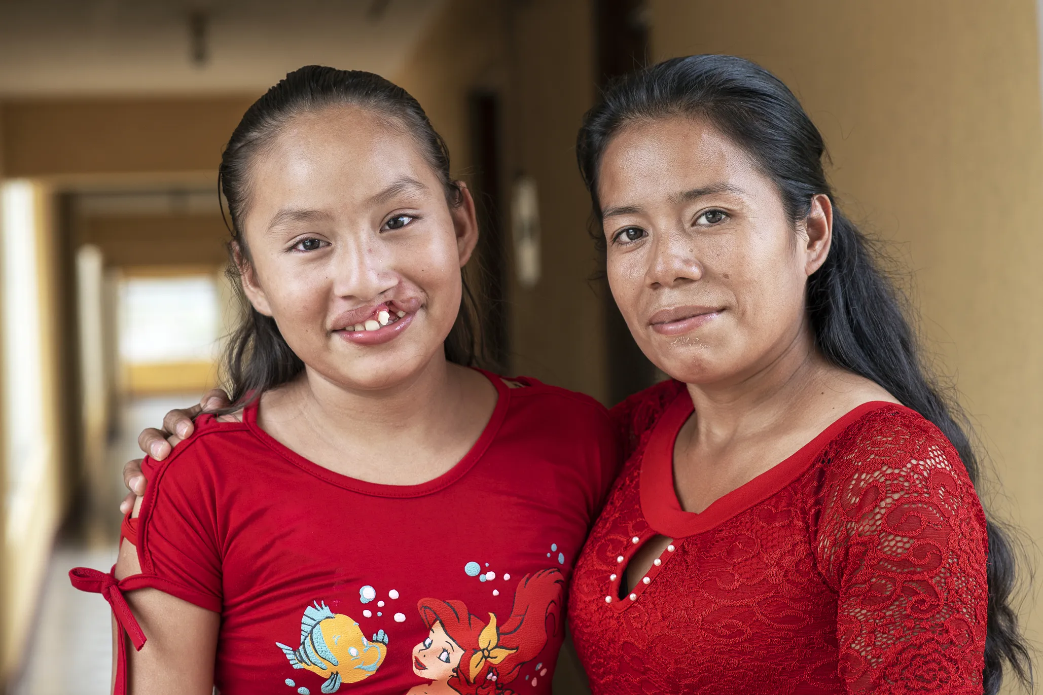 Dayana and her mom during a surgical program in Peten, Guatemala.