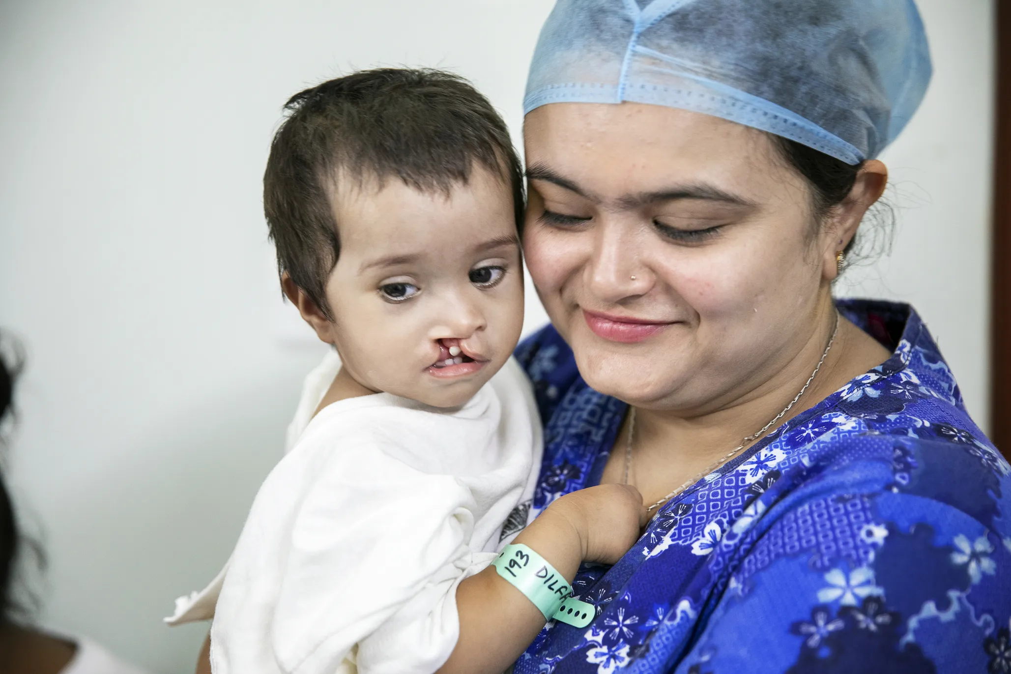 In 2018, Dilfa and her family connected with the local Operation Smile volunteer team in India who provided her with a surgery that would forever change her life.