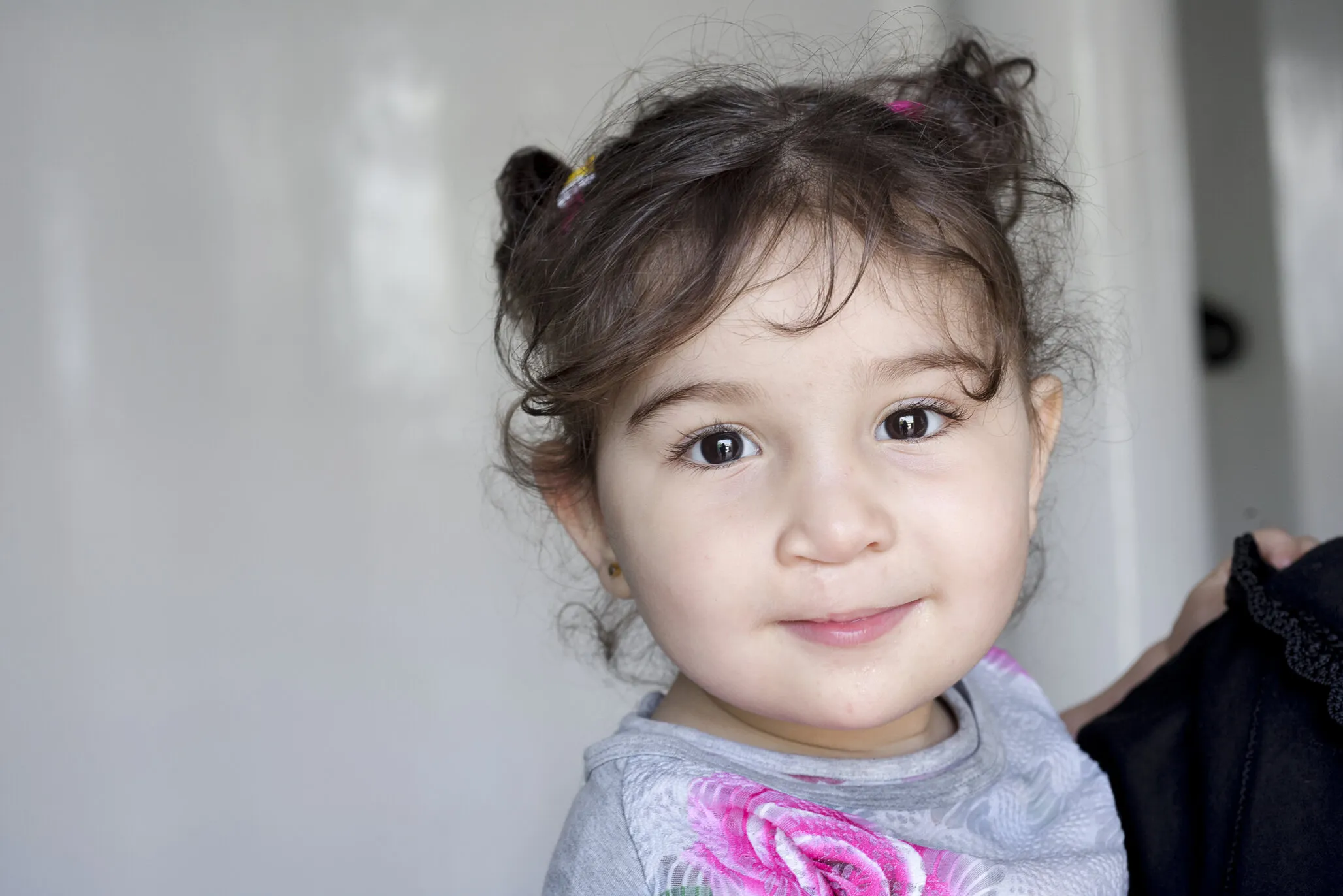 Rania, a year after surgery.