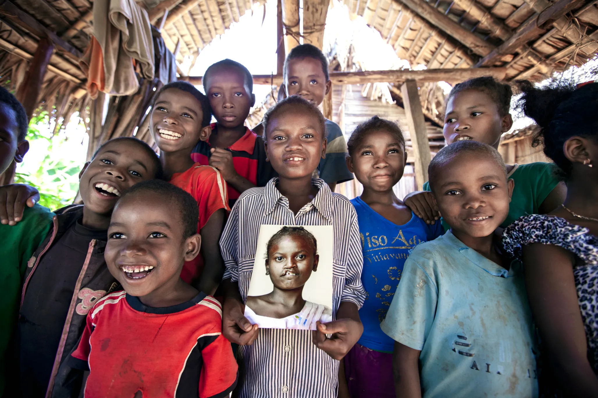 During a follow-up visit to her village, Sandra smiles wide while surrounded by friends and family.