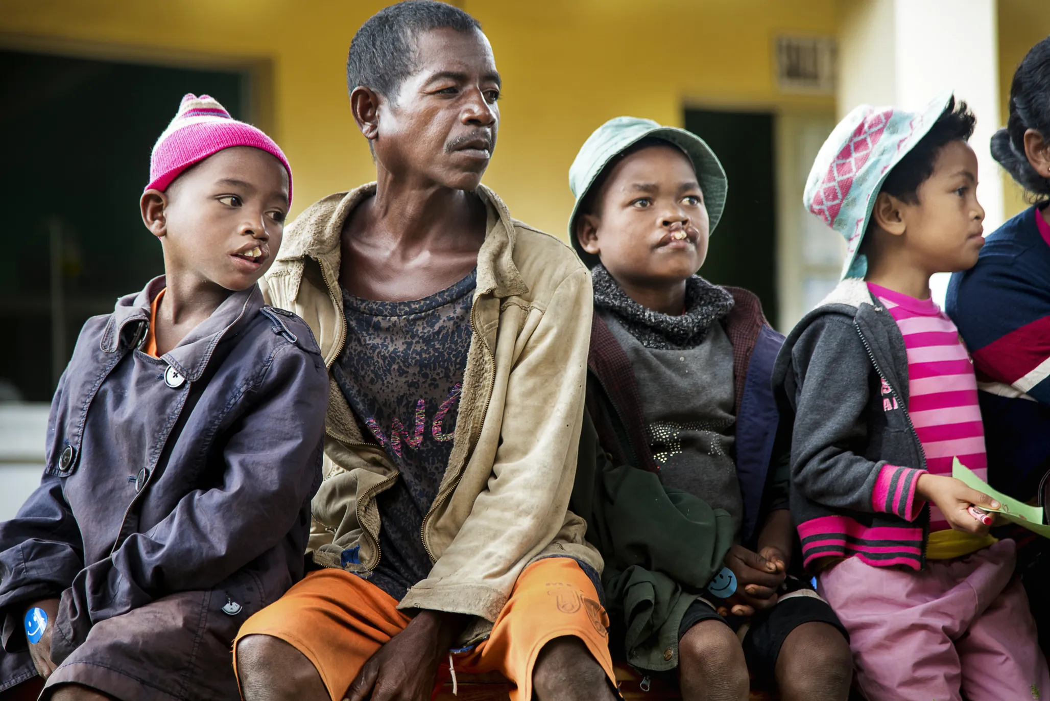 Patients and their family members wait for their consultations with Operation Smile medical volunteers on screening day during the April 2018 medical program in Antsirabe, Madagascar. This program was one of four medical programs that Operation Smile conducted simultaneously to mark the 10-year anniversary of its work in the country. Across the four sites, which also included Tamatave, Majunga and Antananarivo, 650 potential patients were screened to determine whether or not they were healthy enough to receive surgery during these programs