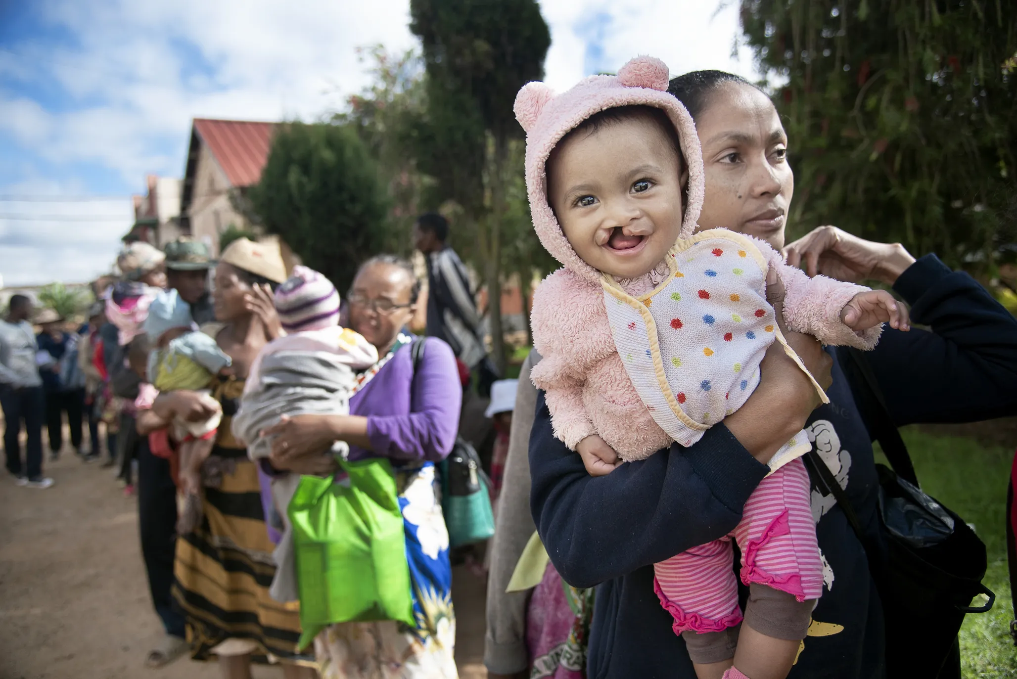 Patient announcement day has arrived in Antsirabe, and 8-month-old Suhurah is all smiles as she waits with her mother to find out if she was chosen for surgery.