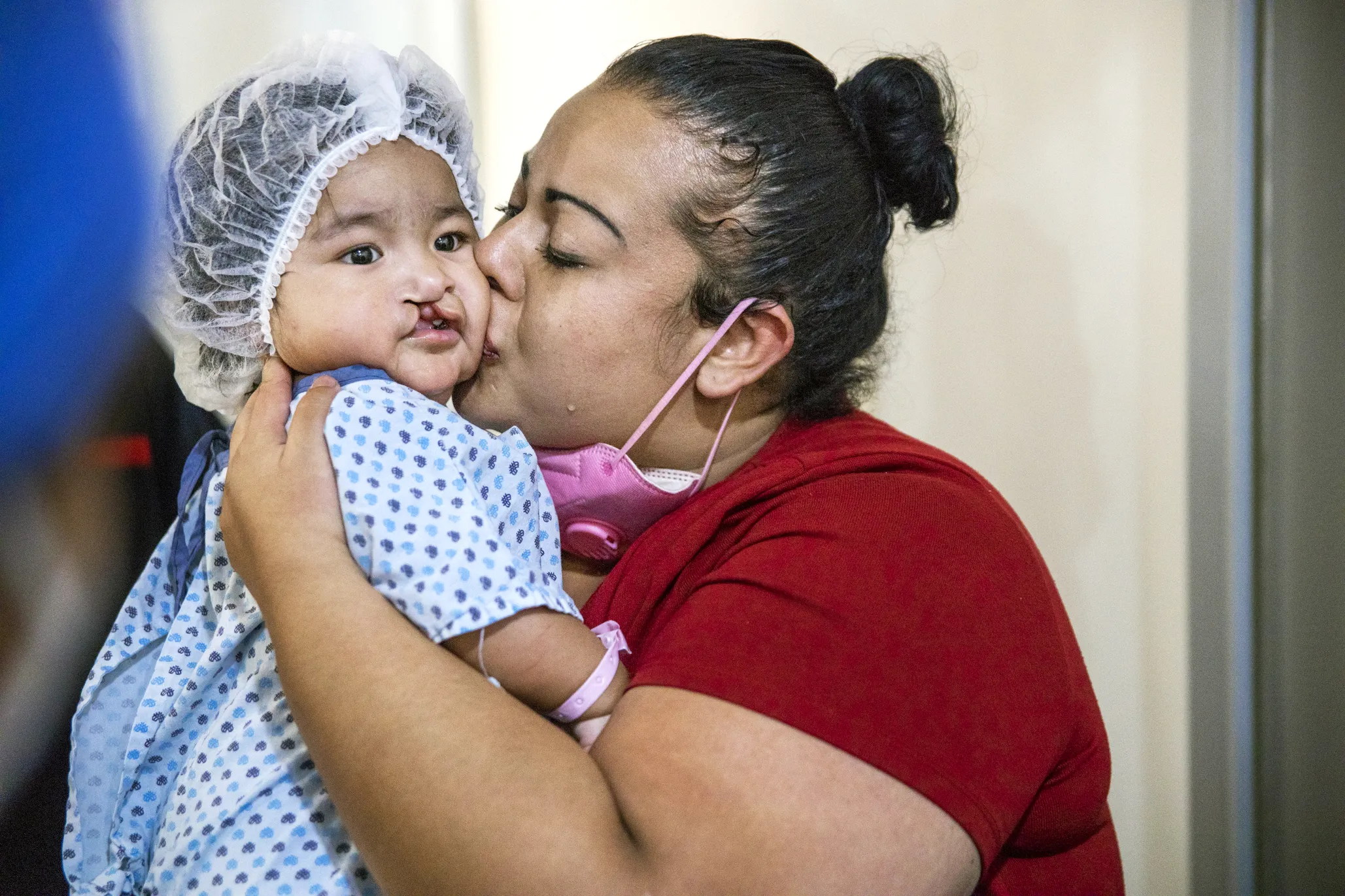 Valeria gives her daughter, Lilia, a kiss before she receives surgery.