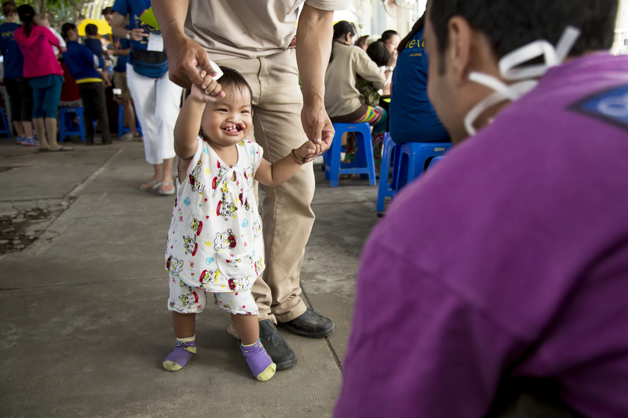 Nguyen smiles wide before surgery during a 2015 Operation Smile Vietnam surgical program.